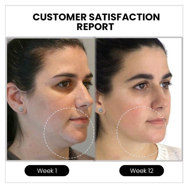 Atheniz MagneTech Acupuncture Earrings(Limited time discount 🔥 last day) - Emporium Shop