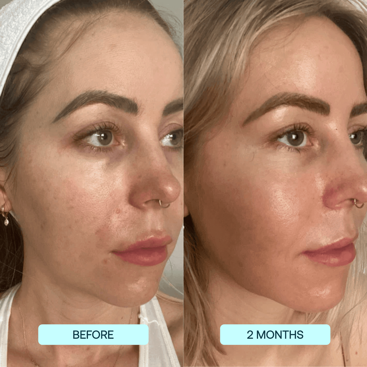 SkynPure™ - Pure Collagen Films - Emporium Shop