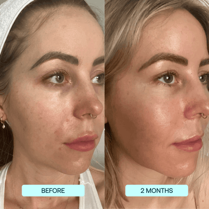 SkynPure™ - Pure Collagen Films - Emporium Shop
