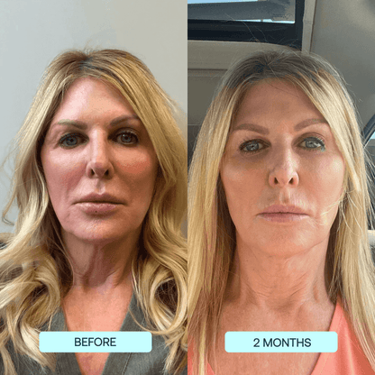 SkynPure™ - Pure Collagen Films - Emporium Shop